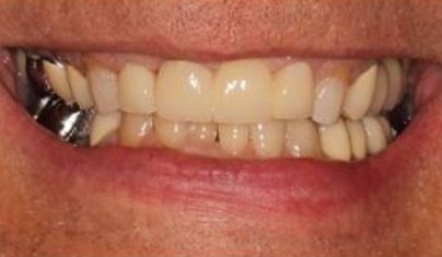 Gorgeous healthy smile after dental treatment
