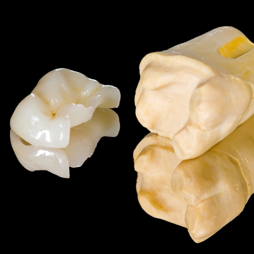 Model smile with metal free dental crowns