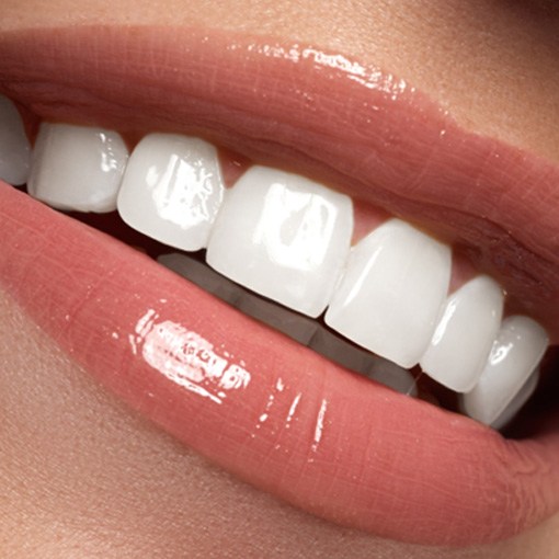 Smile after seeing a cosmetic dentist in Chevy Chase