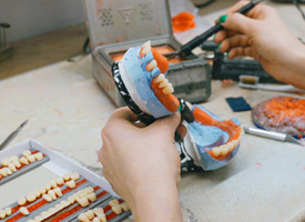 Lab tech adding wax gumline to cast for dentures