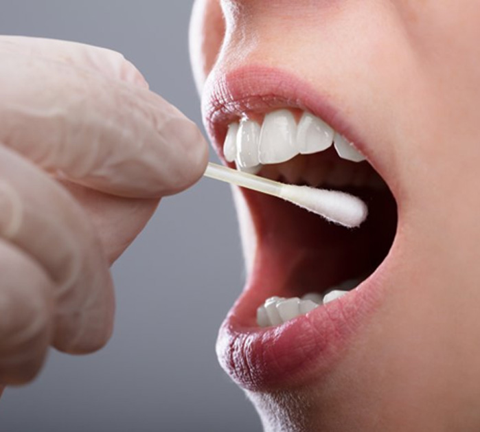 Dentist swabbing a patient’s mouth