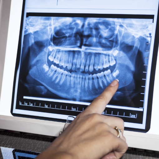 Dentist pointing to all digital dental x-rays