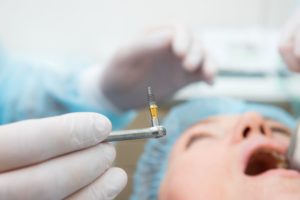 Dentist holding implant with forceps with patient blurry in background